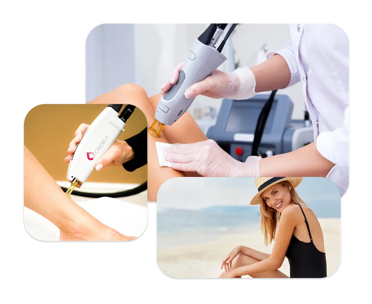 Trust and Technology Combined in Laser Hair Removal