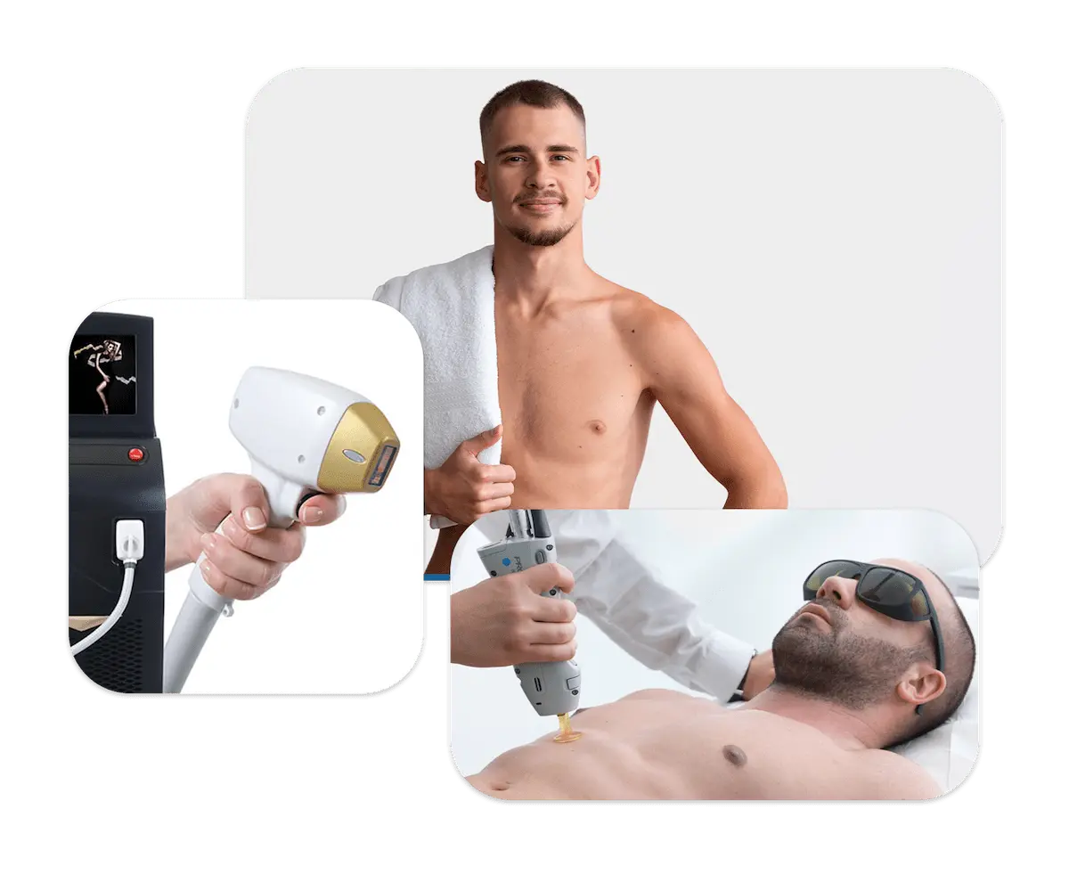 Laser Hair Removal Solutions Tailored for Men
